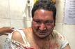Vidwath assault case: HC issues notice to Cubbon Park Police